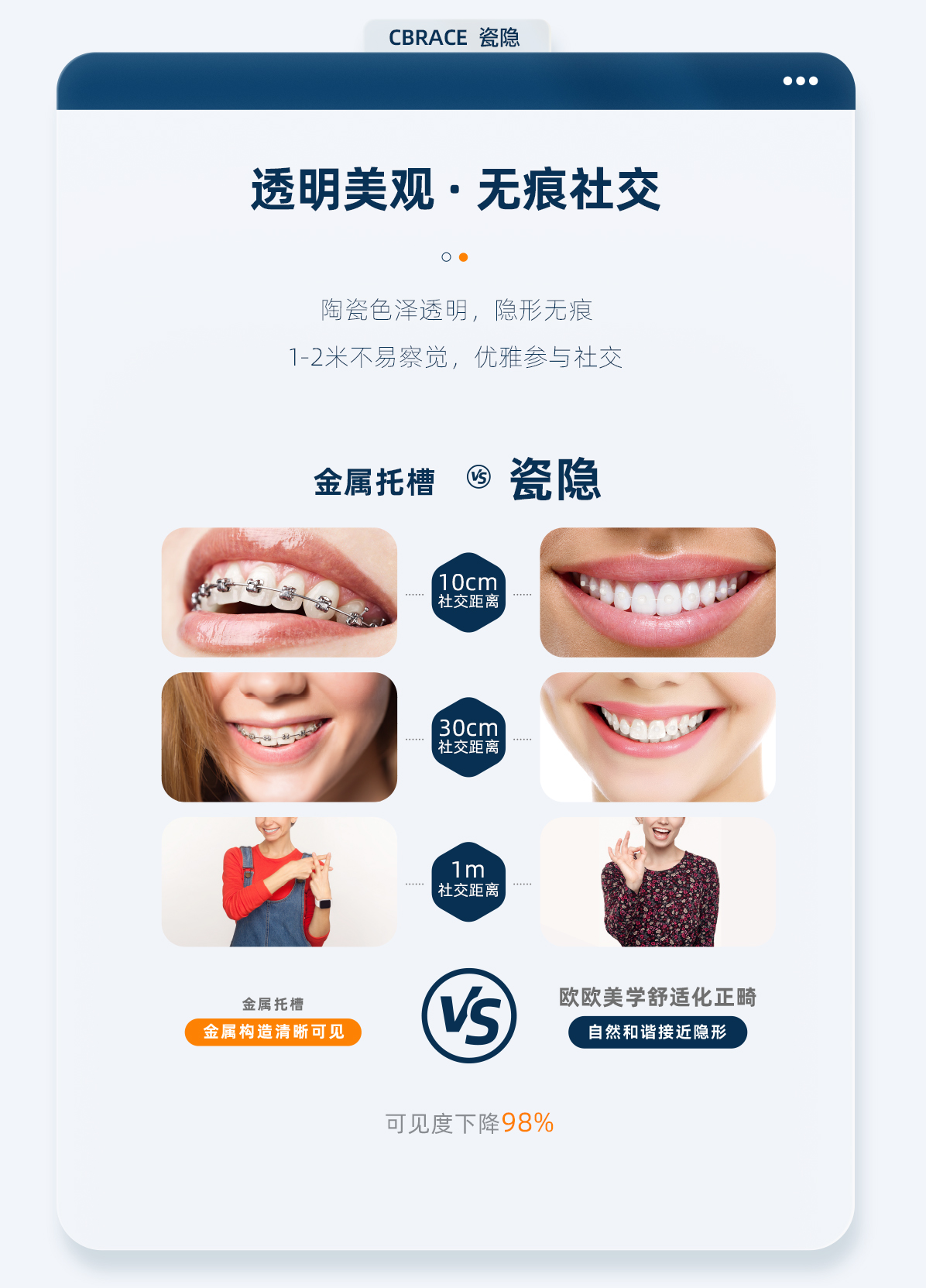 cbrace球托瓷隱版