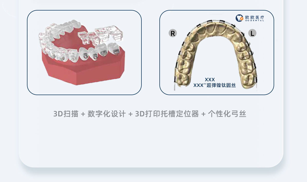 obrace 數字化版