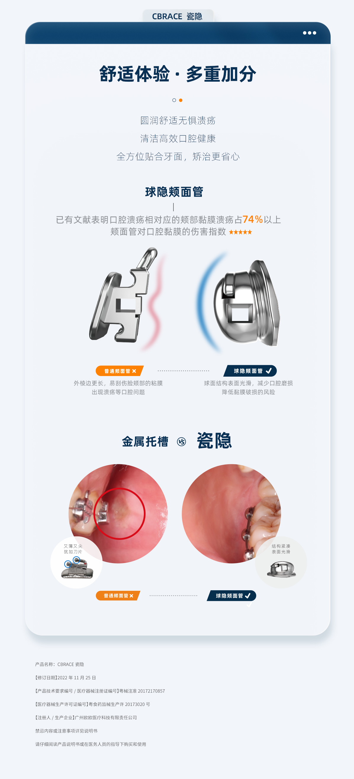 cbrace球托瓷隱版